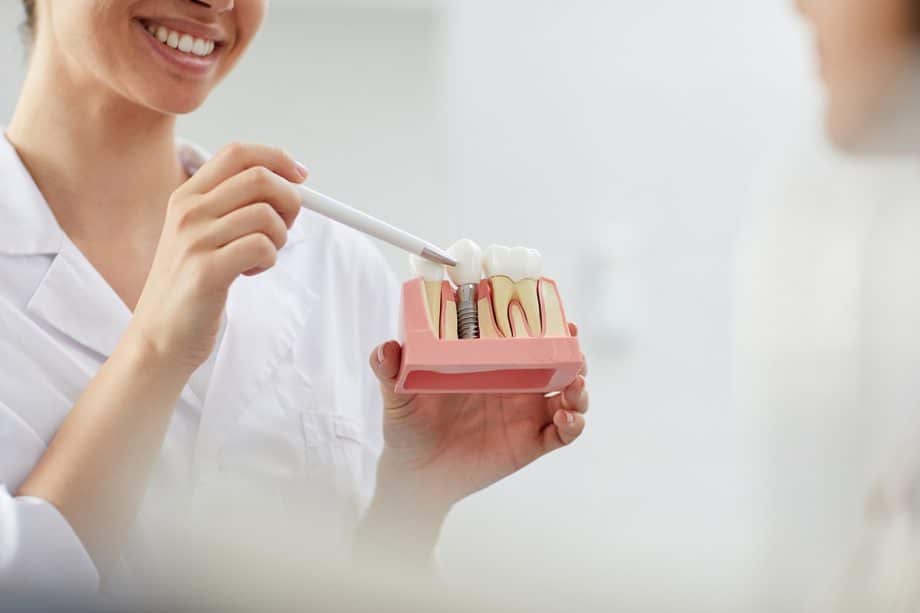 What Are Dental Implant