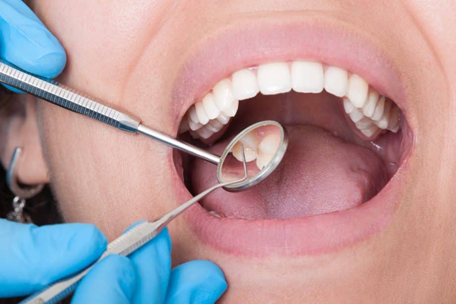 Can I Drive After Getting a Tooth Extraction?