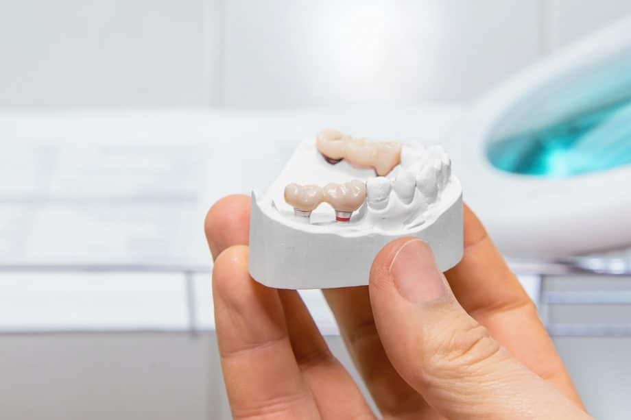 hands holding a model of dental bridge