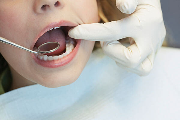 Close-up of child's mouth with dental mirror